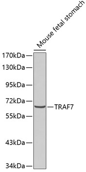 Western blot - TRAF7 Polyclonal Antibody 