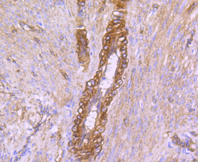 Immunohistochemistry - CAV2 Monoclonal Antibody 