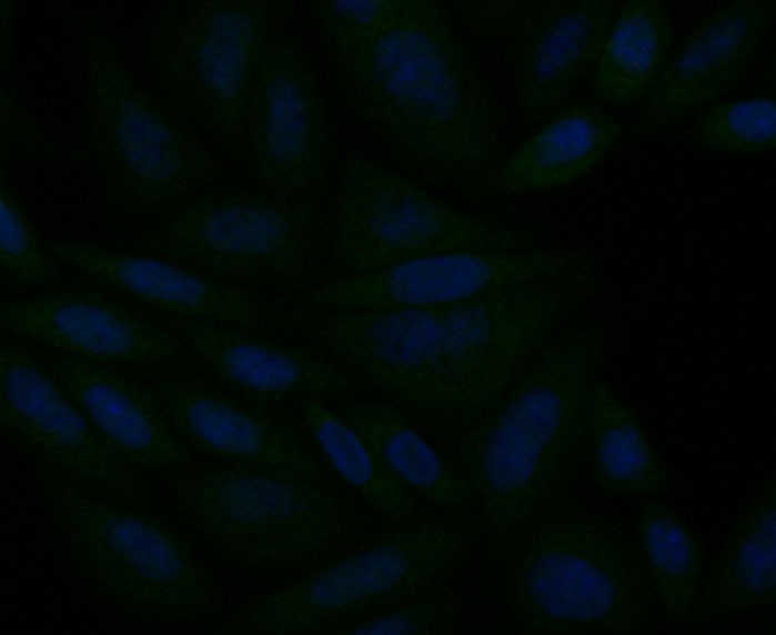 Fig4: ICC staining ITPR2 in SiHa cells (green). The nuclear counter stain is DAPI (blue). Cells were fixed in paraformaldehyde, permeabilised with 0.25% Triton X100/PBS.