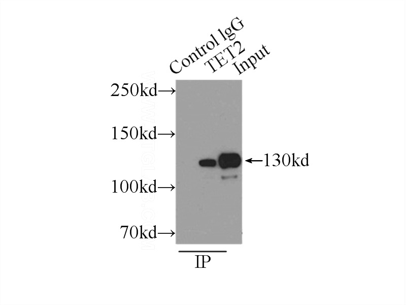 IP Result of anti-TET2 (IP:Catalog No:115953, 3ug; Detection:Catalog No:115953 1:500) with mouse brain tissue lysate 4000ug.