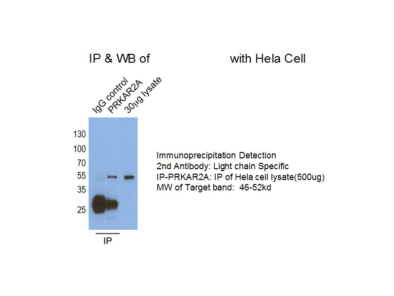IP result of anti-PRKAR2A(Catalog No:114197 for IP and Detection).