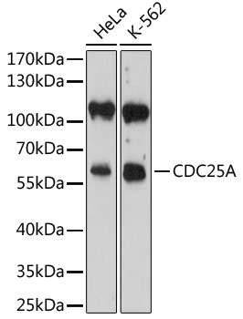 Immunohistochemistry - CDC25A Polyclonal Antibody 