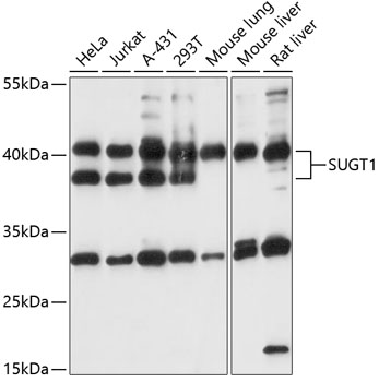 Western blot - SUGT1 Polyclonal Antibody 