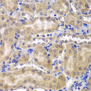 Immunohistochemistry - RPL5 Polyclonal Antibody 