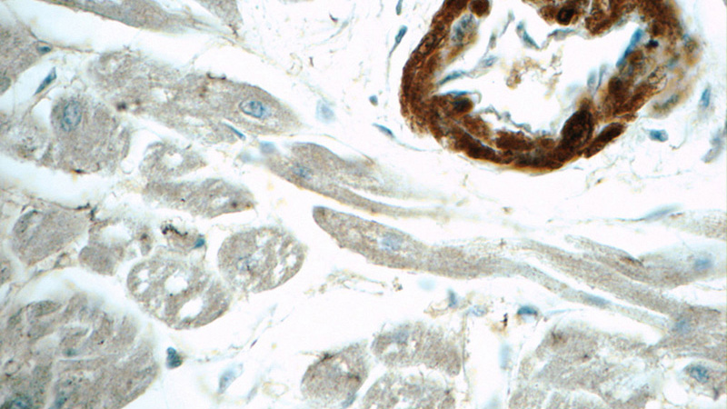 Immunohistochemistry of paraffin-embedded human heart tissue slide using Catalog No:108906(Calponin Antibody) at dilution of 1:50 (under 40x lens)