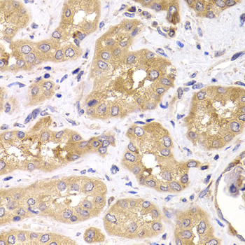 Immunohistochemistry - RPS4X Polyclonal Antibody 