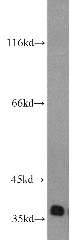 mouse liver tissue were subjected to SDS PAGE followed by western blot with Catalog No:110557(FBXO6 antibody) at dilution of 1:300