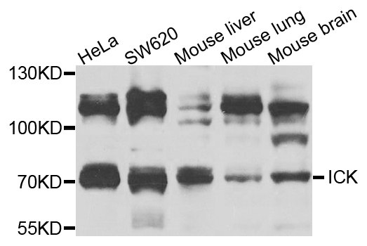 Western blot - ICK Polyclonal Antibody 