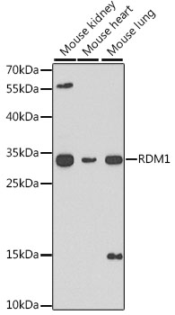 Western blot - RDM1 Polyclonal Antibody 