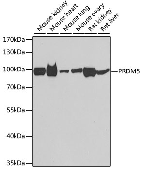 Western blot - PRDM5 Polyclonal Antibody 