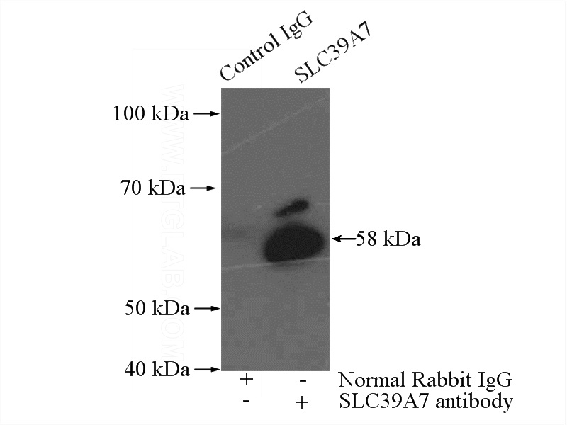 IP Result of anti-SLC39A7 (IP:Catalog No:117061, 4ug; Detection:Catalog No:117061 1:500) with mouse brain tissue lysate 4000ug.
