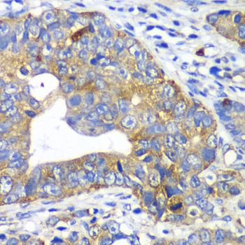 Immunohistochemistry - ARFGAP1 Polyclonal Antibody 