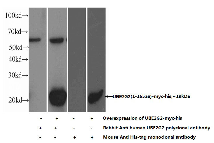 Transfected HEK-293 cells were subjected to SDS PAGE followed by western blot with Catalog No:116526(UBE2G2 Antibody) at dilution of 1:1000