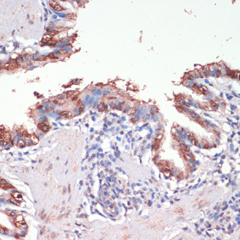 Immunohistochemistry - MSI1 Polyclonal Antibody 