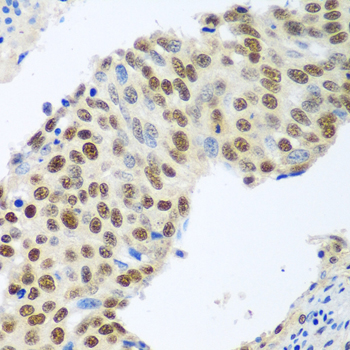 Immunohistochemistry - MDC1 Polyclonal Antibody 