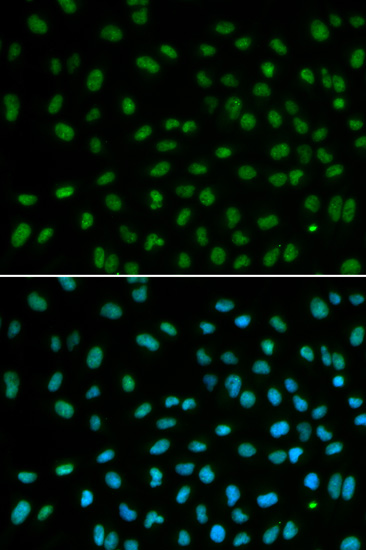 Immunofluorescence - DDB2 Polyclonal Antibody 
