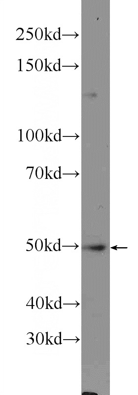 BxPC-3 cells were subjected to SDS PAGE followed by western blot with Catalog No:113238(NLE1 Antibody) at dilution of 1:300