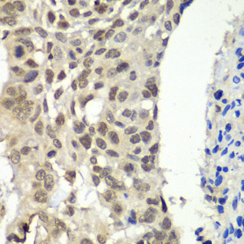 Immunohistochemistry - SSRP1 Polyclonal Antibody 