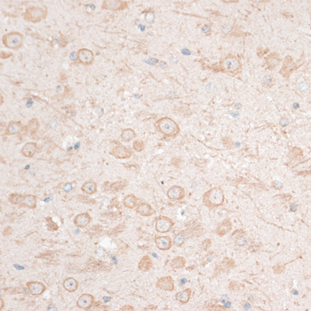 Immunohistochemistry - HMGA1 Polyclonal Antibody 