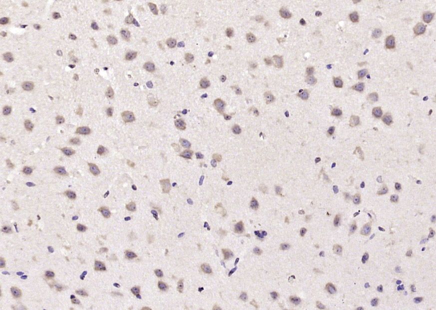 Fig1: Paraformaldehyde-fixed, paraffin embedded (mouse brain); Antigen retrieval by boiling in sodium citrate buffer (pH6.0) for 15min; Block endogenous peroxidase by 3% hydrogen peroxide for 20 minutes; Blocking buffer (normal goat serum) at 37℃ for 30min; Antibody incubation with (α-TAT) Polyclonal Antibody, Unconjugated at 1:200 overnight at 4℃, followed by operating according to SP Kit(Rabbit) (sp-0023) instructionsand DAB staining.