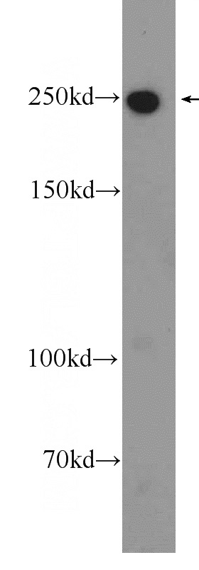 mouse brain tissue were subjected to SDS PAGE followed by western blot with Catalog No:112977(MYO10 Antibody) at dilution of 1:600