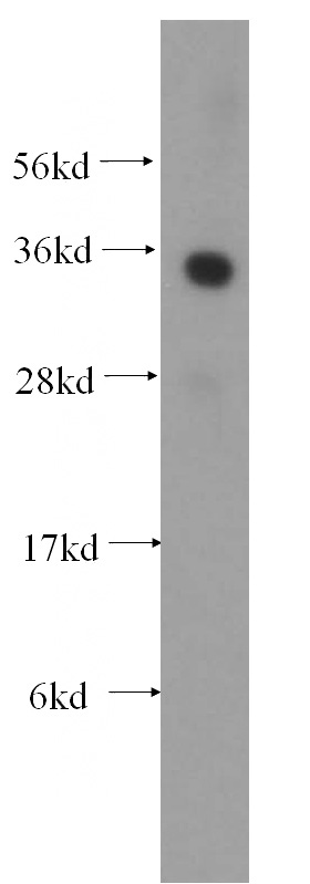 HeLa cells were subjected to SDS PAGE followed by western blot with Catalog No:108282(ATF1 antibody) at dilution of 1:500