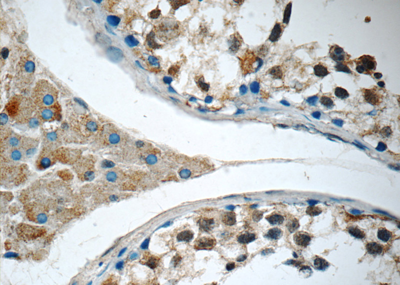 Immunohistochemistry of paraffin-embedded human testis tissue slide using Catalog No:115448(SNAPC5 Antibody) at dilution of 1:50