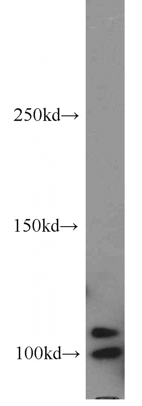 HeLa cells were subjected to SDS PAGE followed by western blot with Catalog No:114306(PAXIP1 antibody) at dilution of 1:500
