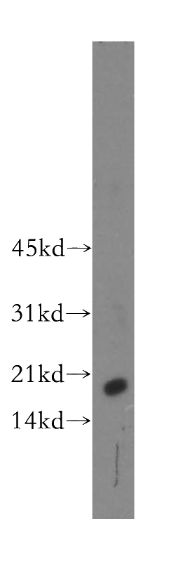 human kidney tissue were subjected to SDS PAGE followed by western blot with Catalog No:109615(CST9L antibody) at dilution of 1:500
