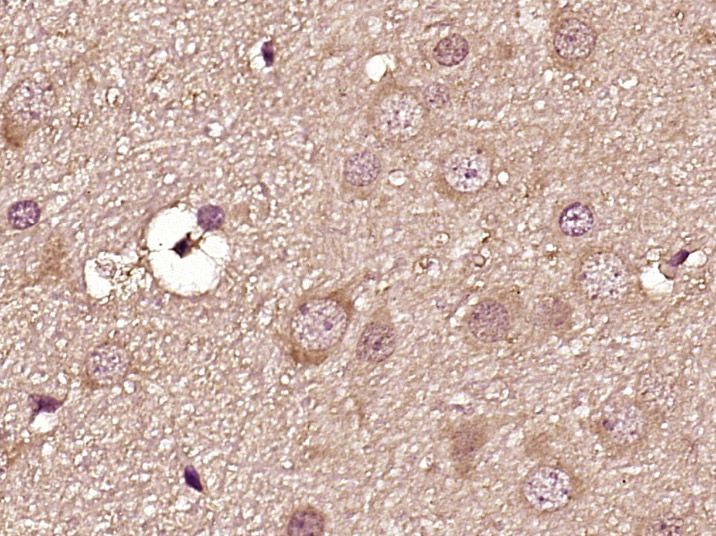 Fig1: Paraformaldehyde-fixed, paraffin embedded (Rat brain); Antigen retrieval by boiling in sodium citrate buffer (pH6.0) for 15min; Block endogenous peroxidase by 3% hydrogen peroxide for 20 minutes; Blocking buffer (normal goat serum) at 37℃ for 30min; Antibody incubation with (Dopamine D3 receptor) Polyclonal Antibody, Unconjugated at 1:400 overnight at 4℃, followed by operating according to SP Kit(Rabbit) (sp-0023) instructionsand DAB staining.