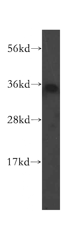 human colon tissue were subjected to SDS PAGE followed by western blot with Catalog No:115828(SULT1B1 antibody) at dilution of 1:600