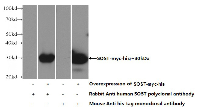 Transfected HEK-293 cells were subjected to SDS PAGE followed by western blot with Catalog No:114998(SOST Antibody) at dilution of 1:1000