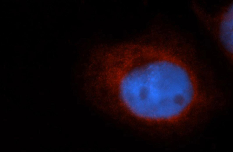 Immunofluorescent analysis of A431 cells, using SLC30A7 antibody Catalog No:117258 at 1:50 dilution and Rhodamine-labeled goat anti-rabbit IgG (red). Blue pseudocolor = DAPI (fluorescent DNA dye).