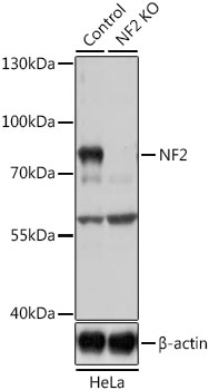 Western blot - NF2 Polyclonal Antibody 