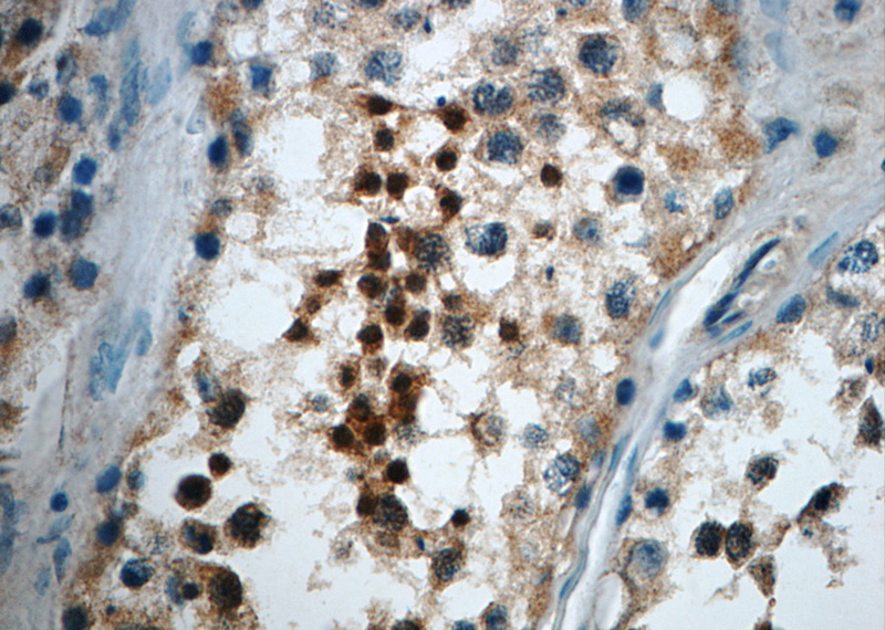 Immunohistochemistry of paraffin-embedded human testis slide using Catalog No:108959(CCDC104 Antibody) at dilution of 1:50