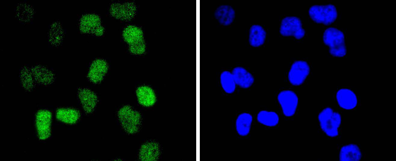 Fig3: ICC staining CDC40 in HUVEC cells (green). The nuclear counter stain is DAPI (blue). Cells were fixed in paraformaldehyde, permeabilised with 0.25% Triton X100/PBS.