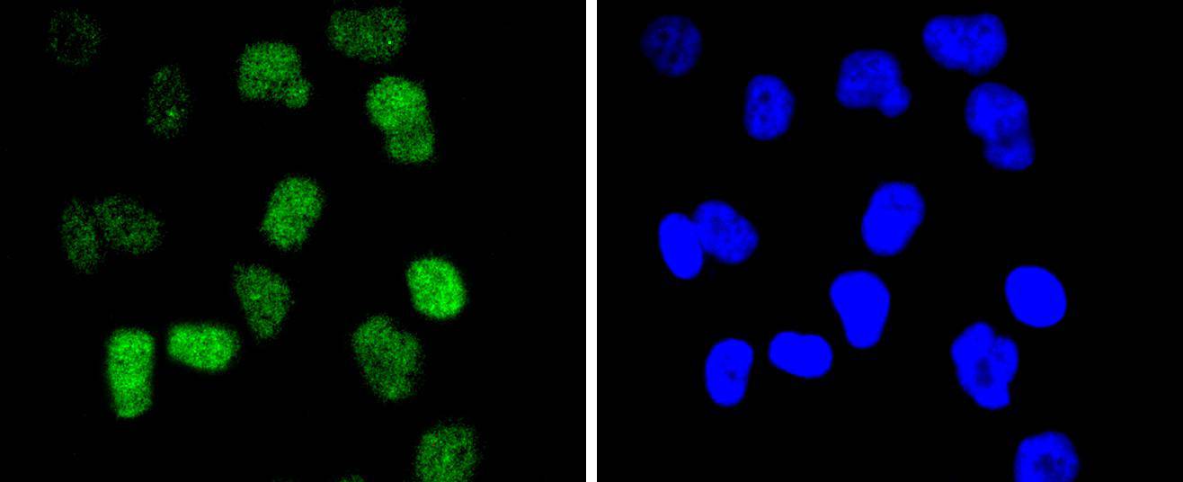 Fig3: ICC staining CDC40 in HUVEC cells (green). The nuclear counter stain is DAPI (blue). Cells were fixed in paraformaldehyde, permeabilised with 0.25% Triton X100/PBS.