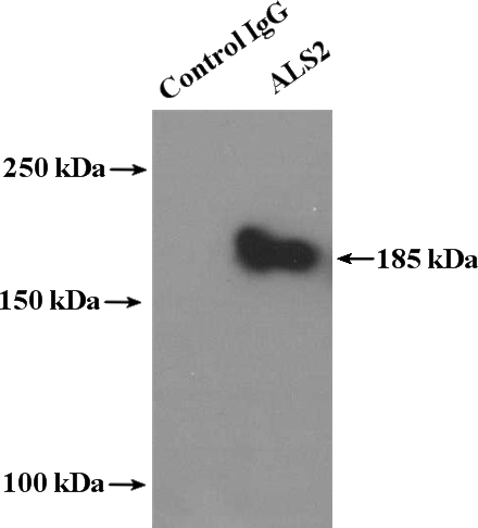 IP Result of anti-ALS2 (IP:Catalog No:107884, 4ug; Detection:Catalog No:107884 1:300) with HEK-293 cells lysate 4000ug.