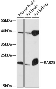 Western blot - RAB25 Polyclonal Antibody 