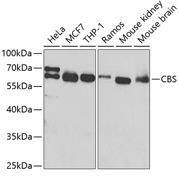 Western blot - CBS Polyclonal Antibody 