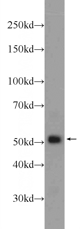 HEK-293 cells were subjected to SDS PAGE followed by western blot with Catalog No:111058(GPATCH4 Antibody) at dilution of 1:1000