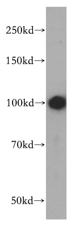 human liver tissue were subjected to SDS PAGE followed by western blot with Catalog No:111861(ITGA9 antibody) at dilution of 1:400