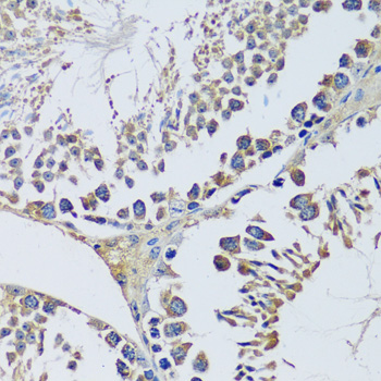 Immunohistochemistry - BLOC1S3 Polyclonal Antibody 