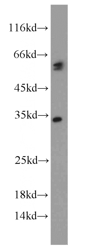 HepG2 cells were subjected to SDS PAGE followed by western blot with Catalog No:108879(CASP8 antibody) at dilution of 1:1000