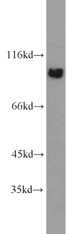 HeLa cells were subjected to SDS PAGE followed by western blot with Catalog No:116722(VAV2 antibody) at dilution of 1:1000