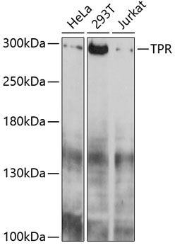 Western blot - TPR Polyclonal Antibody 