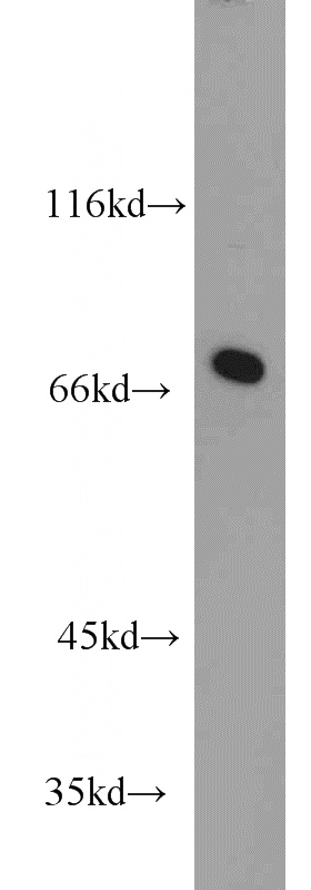 mouse heart tissue were subjected to SDS PAGE followed by western blot with Catalog No:116846(WBP11 antibody) at dilution of 1:1000