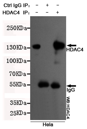 Immunoprecipitation analysis of Hela cell lysates using HDAC4 mouse mAb.