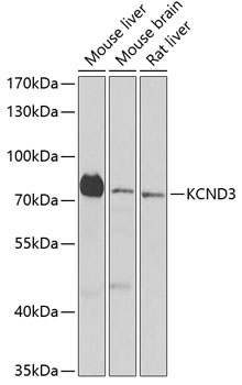 Western blot - KCND3 Polyclonal Antibody 