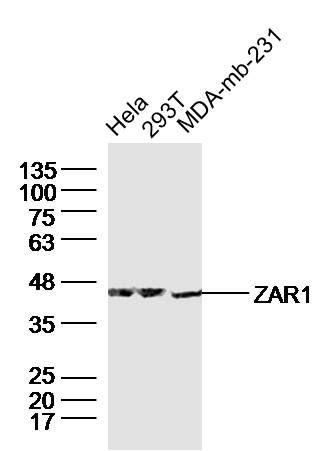 Fig1: Sample:; Hela (human)Cell Lysate at 40 ug; 293T (human)Cell Lysate at 40 ug; MDA-MB-231 (human)Cell Lysate at 40 ug; Primary: Anti-alpha smooth muscle Actin (bs-10196R) at 1/300 dilution; Secondary: IRDye800CW Goat Anti-Rabbit IgG at 1/20000 dilution; Predicted band size: 42 kD; Observed band size: 42 kD